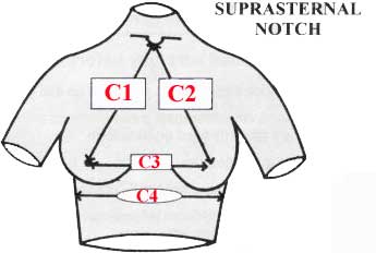 Reference Diagram for pressure garment of female patients
